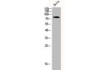 Western Blot analysis of hela cells using CD44 Polyclonal Antibody