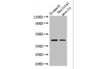 Western Blot<br />
Positive WB detected in:Mouse stomach tissue,Mouse skeletal muscle tissue<br />
All lanes: AGTR1 antibody at 3ug/ml<br />
Secondary<br />
Goat polyclonal to rabbit IgG at 1/50000 dilution<br />
Predicted band size: 42 kDa<br />
Observed