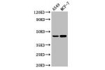 Western Blot<br />
Positive WB detected in:A549 whole cell lysate,MCF-7 whole cell lysate<br />
All lanes:Agxt antibody at 3