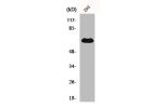 Western Blot analysis of 293 cells using CD5 Polyclonal Antibody