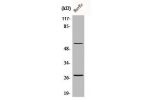 Western Blot analysis of HuvEc cells using CD69 Polyclonal Antibody