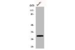 Western Blot analysis of COLO205 cells using CD70 Polyclonal Antibody