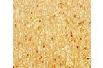 Immunohistochemistry of paraffin-embedded human brain tissue using CSB-PA001481LA01HU at dilution of 1:100