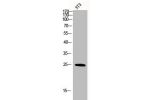 Western Blot analysis of 3T3 cells using CD9 Polyclonal Antibody
