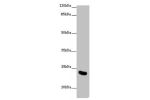 Western blot<br />
All lanes: AICDA antibody at 10 ug/ml+ Mouse liver tissue<br />
Secondary<br />
Goat polyclonal to rabbit IgG at 1/10000 dilution<br />
Predicted band size: 24,23 kDa<br />
Observed band size: 24 kDa<br />