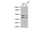 Western Blot<br />
Positive WB detected in:K562 whole cell lysate,SH-SY5Y whole cell lysate<br />
All lanes: AIM2 antibody at 2.7ug/ml<br />
Secondary<br />
Goat polyclonal to rabbit IgG at 1/50000 dilution<br />
Predicted band size: 39 kDa<br />
Observed