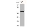 Western Blot analysis of Jurkat cells using Cdc25C Polyclonal Antibody