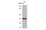 Western Blot analysis of COLO205 cells using Cdc34 Polyclonal Antibody