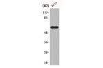 Western Blot analysis of HeLa cells using Cdc6 Polyclonal Antibody
