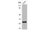 Western Blot analysis of HepG2 cells using CdcA3 Polyclonal Antibody