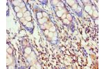 Immunohistochemistry of paraffin-embedded human rectum using CSB-PA001527ESR2HU at dilution 1:100
