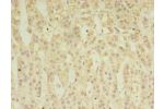 Immunohistochemistry of paraffin-embedded human adrenal gland tissue using CSB-PA001529LA01HU at dilution 1:100