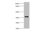 All lanes:Aldo-keto reductase family 1 member B10 antibody at 4ug/ml+A549 whole cell lysate<br />
Secondary<br />
Goat polyclonal to rabbit at 1/10000 dilution<br />
Predicted band size: 36kDa<br />
Observed band size: 36kDa<br />