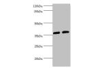 All lanes:Aldo-keto reductase family 1 member C3 antibody at 8ug/ml<br />
Lane 1:K562 whole cell lysate<br />
Lane 2:293T whole cell lysate<br />
Secondary<br />
Goat polyclonal to rabbit at 1/10000 dilution<br />
Predicted band size: 37,24 kDa<br />
Obse