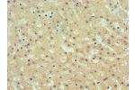 Immunohistochemistry of paraffin-embedded human liver using CSB-PA001545ESR1HU at dilution 1:100