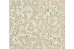 Immunohistochemistry of paraffin-embedded human liver tissue using CSB-PA001550ESR2HU at dilution 1:100