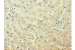 Immunohistochemistry of paraffin-embedded human liver using CSB-PA001551ESR1HU at dilution 1:100
