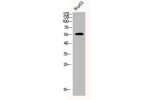 Western Blot analysis of HEPG2 cells using CDYL2 Polyclonal Antibody