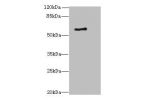 Western blot<br />
All lanes: ALAS2 antibody at 6ug/ml+K562 whole cell lysate<br />
Goat polyclonal to rabbit at 1/10000 dilution<br />
Predicted band size: 65,61,50,64 kDa<br />
Observed band size: 65 kDa<br />