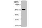 Western blot<br />
All lanes: Aldh1a1 antibody at 8ug/ml+ Mouse eye tissue<br />
Goat polyclonal to rabbit at 1/10000 dilution<br />
Predicted band size: 55 kDa<br />
Observed band size: 55 kDa<br />