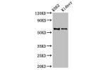 Western Blot<br />
Positive WB detected in:K562 whole cell lysate,Mouse kidney tissue<br />
All lanes:ALDH1A2 antibody at 3.5