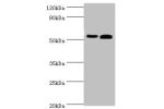 Western blot<br />
All lanes:Retinal dehydrogenase 2 antibody at 14ug/ml<br />
Lane 1:K562 whole cell lysate<br />
Lane 2:mouse liver tissue<br />
Secondary<br />
Goat polyclonal to rabbit at 1/10000 dilution<br />
Predicted band size: 57,54,55,47 kDa<br 