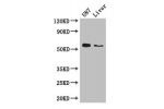 Western Blot<br />
Positive WB detected in:U87 whole cell lysate,Mouse liver tissue<br />
All lanes: ALDH1A3 antibody at 3ug/ml<br />
Secondary<br />
Goat polyclonal to rabbit IgG at 1/50000 dilution<br />
Predicted band size: 57 kDa<br />
Observed band s