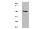 Western blot<br />
All lanes:ALDH3A1 antibody at 2ug/ml+293T whole cell lysate<br />
Secondary<br />
Goat polyclonal to rabbit at 1/10000 dilution<br />
Predicted band size: 50kDa<br />
Observed band size: 50kDa<br />