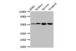 Western Blot<br />
Positive WB detected in:K562 whole cell lysate,Rat kidney tissue,Rat spleen tissue,Mouse stomach tissue<br />
All lanes:ALDH3B1 antibody at 3