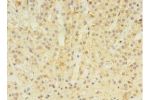 Immunohistochemistry of paraffin-embedded human adrenal gland using CSB-PA001575LA01HU at dilution 1:100