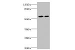 All lanes:Delta-1-pyrroline-5-carboxylate dehydrogenase, mitochondrial antibody at 13ug/ml<br />
Lane 1:K562 whole cell lysate<br />
Lane 2:293T whole cell lysate<br />
Secondary<br />
Goat polyclonal to rabbit at 1/10000 dilution<br />
Predicted band siz