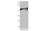 Western blot<br />
All lanes: ALDH5A1 antibody at 8ug/ml<br />
Lane 1 : Rat heart tissue<br />
Lane 2 : Mouse liver tissue<br />
Lane 3 : Mouse kidney tissue<br />
Lane 4 : A431 whole cell lysate<br />
Lane 5 : 293T whole cell lysate<br />
Secondary<br />