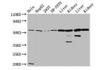 Western Blot<br />
Positive WB detected in:Hela whole cell lysate,HepG2 whole cell lysate,293T whole cell lysate,SH-SY5Y whole cell lysate,Rat liver tissue,Rat kidney tissue,Mouse liver tissue,Mouse kidney tissue<br />
All lanes:ALDH7A1 antibody at 4.7