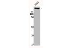 Western Blot analysis of K562 cells using CEP290 Polyclonal Antibody