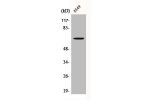 Western Blot analysis of A549 cells using CERKL Polyclonal Antibody