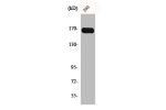 Western Blot analysis of 293 cells using c-Fms Polyclonal Antibody