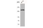 Western Blot analysis of HT29 cells using c-Fms Polyclonal Antibody
