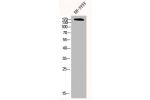 Western Blot analysis of SH-SY5Y cells using CFTR Polyclonal Antibody
