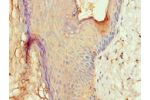 Immunohistochemistry of paraffin-embedded human skin using CSB-PA001622ESR1HU at dilution 1:100