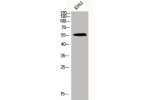 Western Blot analysis of K562 cells using Chk1 Polyclonal Antibody