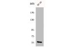 Western Blot analysis of HT29 cells using Chk1 Polyclonal Antibody