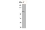 Western Blot analysis of 293 cells using Chk2 Polyclonal Antibody