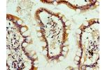 Immunohistochemistry of paraffin-embedded human small intestine using CSB-PA001631ESR2HU at dilution 1:100