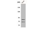 Western Blot analysis of COLO205 cells using Choactase Polyclonal Antibody