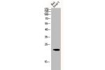 Western Blot analysis of RAT-HEART cells using CHOP Polyclonal Antibody