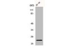 Western Blot analysis of Jurkat cells using CHP2 Polyclonal Antibody