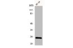 Western Blot analysis of RAW264.7 cells using CIDE-B Polyclonal Antibody