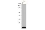 Western Blot analysis of Jurkat cells using Cks1 Polyclonal Antibody