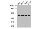 Western Blot<br />
Positive WB detected in:PC3 whole cell lysate,MCF-7 whole cell lysate,HepG2 whole cell lysate,Mouse brain tissue<br />
All lanes: AMACR antibody at 3ug/ml<br />
Secondary<br />
Goat polyclonal to rabbit IgG at 1/50000 dilution<br />
Pre
