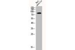 Western Blot analysis of RAT-MUSLE cells using CLC-4 Polyclonal Antibody